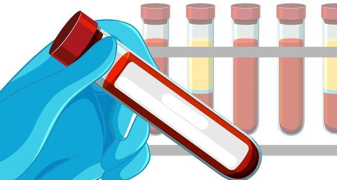 KalVista's (Nasdaq:KALV) Q3: EKTERLY US Launch Drives Revenue to 13.7M USD